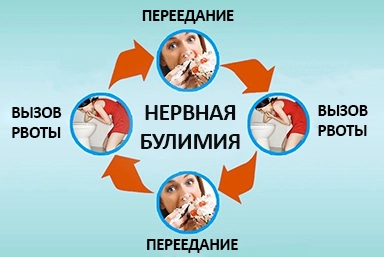 Лечение булимии в Хасавюрте